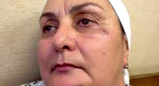 Madina Magomadova after attack in Moscow. Photo by http://www.doshdu.ru/ Madina Magomadova after attack in Moscow. Photo by http://www.doshdu.ru/