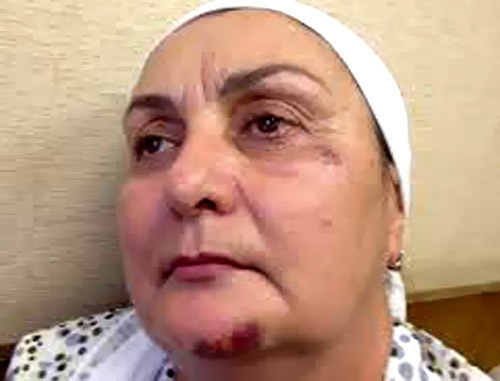 Madina Magomadova after attack in Moscow. Photo by http://www.doshdu.ru/ Madina Magomadova after attack in Moscow. Photo by http://www.doshdu.ru/
