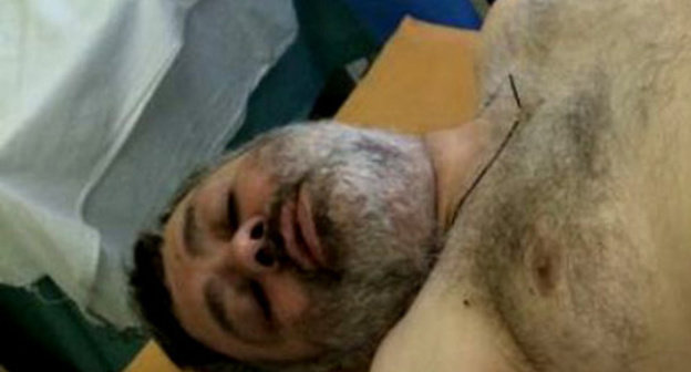 Batyr Pukhaev in the Republican Hospital of South Ossetia. August 2014. Photo courtesy of Indira Djioeva Batyr Pukhaev in the Republican Hospital of South Ossetia. August 2014. Photo courtesy of Indira Djioeva