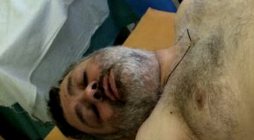 Batyr Pukhaev in the Republican Hospital of South Ossetia. August 2014. Photo courtesy of Indira Djioeva