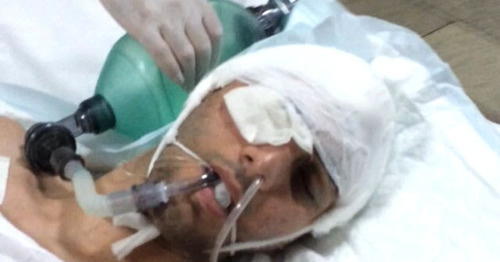 Magomed Aliev in the hospital. Photo by Amina Alieva. Magomed Aliev in the hospital. Photo by Amina Alieva.