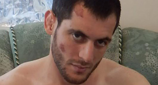 Murad Amriev with the traces of physical injury on August 28, 2013. Photo from the archive of the Joint Mobile Group (JMG) Murad Amriev with the traces of physical injury on August 28, 2013. Photo from the archive of the Joint Mobile Group (JMG)
