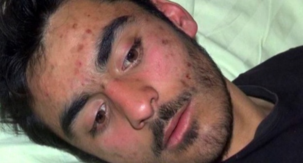 Radil Mirzaev. Photo: Report.az/ru/proisshestviya/v-azerbajdzhane-pohishennyj-neizvestnymi-v-maskah-molodoj-chelovek-najden-v-bessoznatel-nom-sostoyanii