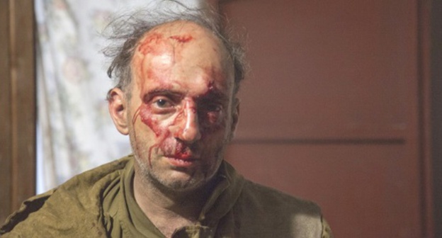 Mikhail Kreyndlin, one of the "Greenpeace" activists, after being attacked. Photo: Greenpeace.org Mikhail Kreyndlin, one of the "Greenpeace" activists, after being attacked. Photo: Greenpeace.org