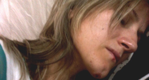 Sapiyat Magomedova after being beaten at police station. Photo is provided by Human Rights Centre 'Memorial'. Sapiyat Magomedova after being beaten at police station. Photo is provided by Human Rights Centre 'Memorial'.