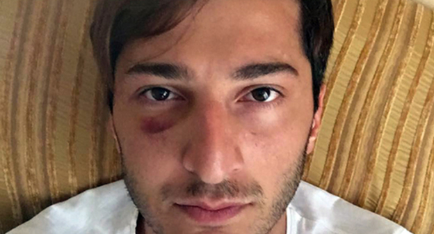 Gay activist beaten in Batumi, Facebook/Tornike Kusiani Gay activist beaten in Batumi, Facebook/Tornike Kusiani
