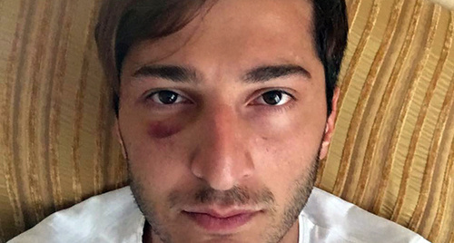 Gay activist beaten in Batumi, Facebook/Tornike Kusiani Gay activist beaten in Batumi, Facebook/Tornike Kusiani