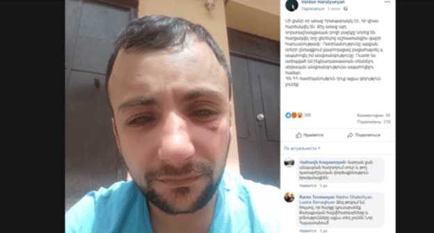 Beaten Vardan Arutyunyan. Screenshot of his Facebook post dated June 3: https://www.facebook.com/photo.php?fbid=2453172568055999&set=a.618587571514517&type=3&theater Beaten Vardan Arutyunyan. Screenshot of his Facebook post dated June 3: https://www.facebook.com/photo.php?fbid=2453172568055999&set=a.618587571514517&type=3&theater