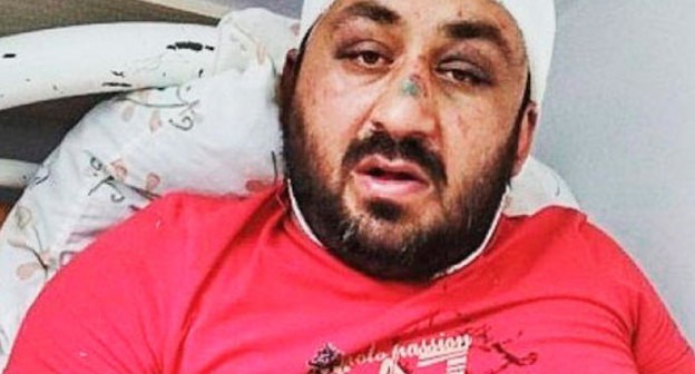 Islam Saritov, a resident of Khasavyurt. Photo by the press service of the Human Rights Centre "Memorial" https://memohrc.org/ru/news_old/v-dagestane-byvshiy-policeyskiy-zhestoko-izbil-mestnogo-zhitelya Islam Saritov, a resident of Khasavyurt. Photo by the press service of the Human Rights Centre "Memorial" https://memohrc.org/ru/news_old/v-dagestane-byvshiy-policeyskiy-zhestoko-izbil-mestnogo-zhitelya