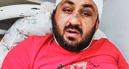 Islam Saritov, a resident of Khasavyurt. Photo by the press service of the Human Rights Centre "Memorial" https://memohrc.org/ru/news_old/v-dagestane-byvshiy-policeyskiy-zhestoko-izbil-mestnogo-zhitelya Islam Saritov, a resident of Khasavyurt. Photo by the press service of the Human Rights Centre "Memorial" https://memohrc.org/ru/news_old/v-dagestane-byvshiy-policeyskiy-zhestoko-izbil-mestnogo-zhitelya