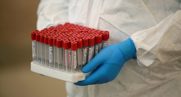 Diagnostic test for COVID-19. Photo: REUTERS/Jose Luis Gonzalez Diagnostic test for COVID-19. Photo: REUTERS/Jose Luis Gonzalez