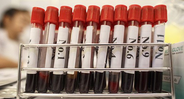 Tubes with blood samples for HIV testing. Photo: REUTERS/Athit Perawongmetha Tubes with blood samples for HIV testing. Photo: REUTERS/Athit Perawongmetha