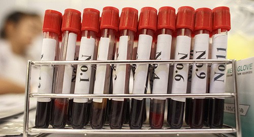 Tubes with blood samples for HIV testing. Photo: REUTERS/Athit Perawongmetha Tubes with blood samples for HIV testing. Photo: REUTERS/Athit Perawongmetha