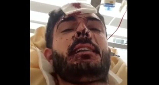 Mukhammed Mirzali after being attacked. Screenshot of the video at the Amon Equalizer YouTube channel https://www.youtube.com/watch?v=nVEhi45e3vg Mukhammed Mirzali after being attacked. Screenshot of the video at the Amon Equalizer YouTube channel https://www.youtube.com/watch?v=nVEhi45e3vg