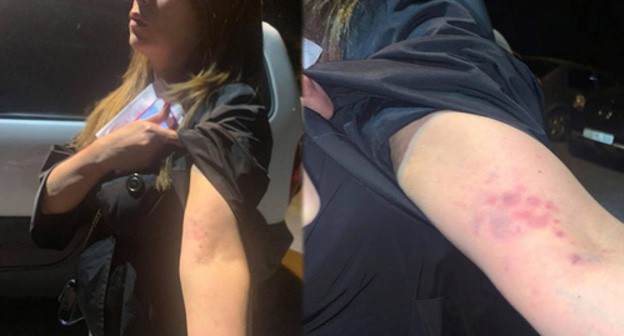 Signs of violence applied by the policemen against Zarui Postandjyan, the head of the "Apricot Country" Party, detained at a protest in Yerevan. Photo https://www.panorama.am/ru/news/2021/05/21/%D0%97%D0%B0%D1%80%D1%83%D0%B8-%D0%9F%D0%BE%D1%81%D1%82%D0%B0%D0%BD%D0%B4%D0%B6%D1%8F%D0%BD/2505968 Signs of violence applied by the policemen against Zarui Postandjyan, the head of the "Apricot Country" Party, detained at a protest in Yerevan. Photo https://www.panorama.am/ru/news/2021/05/21/%D0%97%D0%B0%D1%80%D1%83%D0%B8-%D0%9F%D0%BE%D1%81%D1%82%D0%B0%D0%BD%D0%B4%D0%B6%D1%8F%D0%BD/2505968