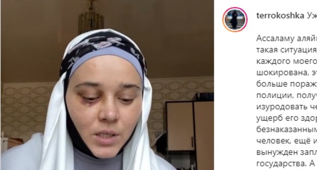 The girl, who moved to Makhachkala because of her religious beliefs, has complained that she was seriously injured in a fight in the hospital. Screenshot of the post https://www.instagram.com/p/CRSEGqEKDtd/ The girl, who moved to Makhachkala because of her religious beliefs, has complained that she was seriously injured in a fight in the hospital. Screenshot of the post https://www.instagram.com/p/CRSEGqEKDtd/