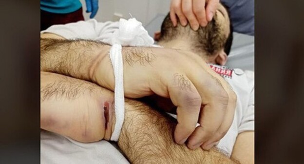 Traces of torture on Inal Djabiev's body. Screenshot https://www.facebook.com/photo/?fbid=946507415829604&set=pcb.2721689724815819 Traces of torture on Inal Djabiev's body. Screenshot https://www.facebook.com/photo/?fbid=946507415829604&set=pcb.2721689724815819