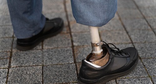 A disabled person. Photo: ru.freepik.com/photos/woman'>Woman photo created by freepik - ru.freepik.com A disabled person. Photo: ru.freepik.com/photos/woman'>Woman photo created by freepik - ru.freepik.com