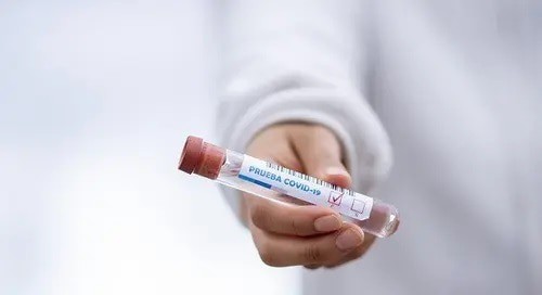 Test tube for PCR test for coronavirus. Photo: pixabay.com Test tube for PCR test for coronavirus. Photo: pixabay.com