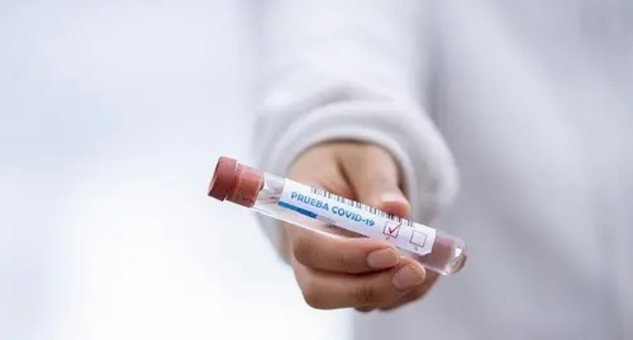Test tube for PCR test for coronavirus. Photo: pixabay.com Test tube for PCR test for coronavirus. Photo: pixabay.com
