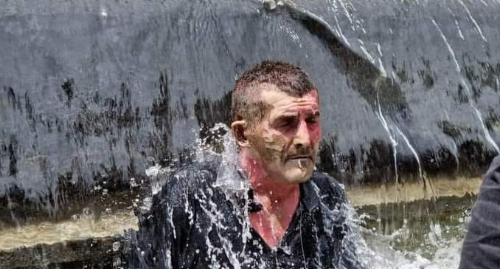 A man who injured himself during protest rally of LGBT opponents at the Parliament of Georgia. Photo: https://cnews.ge/home/news_description/36761/ A man who injured himself during protest rally of LGBT opponents at the Parliament of Georgia. Photo: https://cnews.ge/home/news_description/36761/