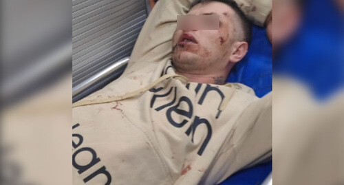 A veteran of the special military operation after being attacked in Rostov-on-Don. Screenshot of a video https://vk.com/wall-88393165_832042 A veteran of the special military operation after being attacked in Rostov-on-Don. Screenshot of a video https://vk.com/wall-88393165_832042