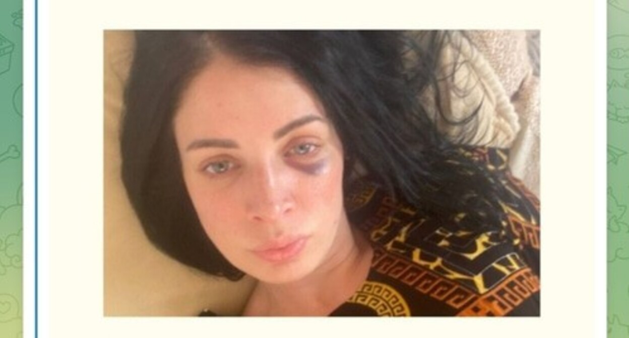 A resident of Krasnodar, who suffered from violence. Screenshot of the post from the Telegram channel of the “Caucasus Without a Mother” human rights project https://t.me/heda_media/975 A resident of Krasnodar, who suffered from violence. Screenshot of the post from the Telegram channel of the “Caucasus Without a Mother” human rights project https://t.me/heda_media/975