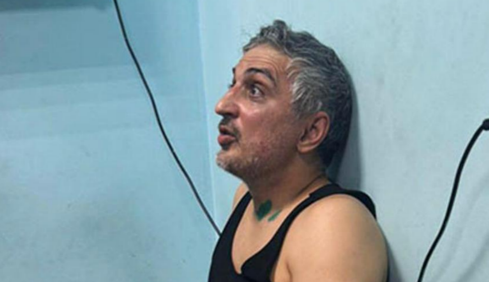 Zaur Kaituev after the beating. Photo courtesy of the "Caucasian Knot."