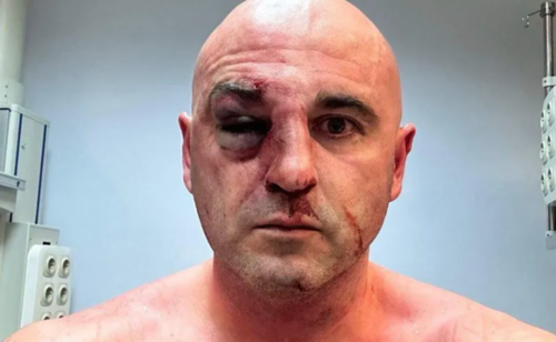Still image of the leader of the "National Movement" Levan Khabeishvili beaten by security forces in 2024. Photo: TV Pirveli / https://tvpirveli.ge/ka/siaxleebi/sazogadoeba/127133-khareba-mtavari-mtsamebeli-unda-ikos-dasjili-tu-arada-es-kvelaperi-aris-parsi